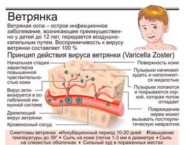 Действие вируса ветрянки