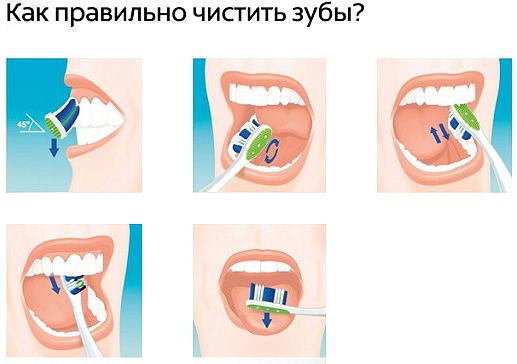 Как правильно чистить зубы