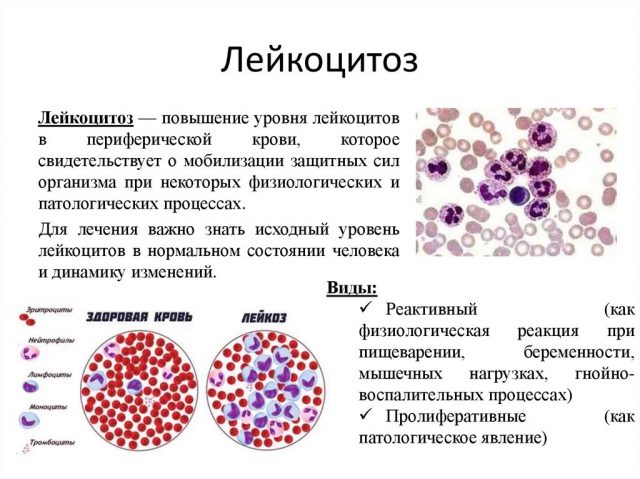 лейкоциты