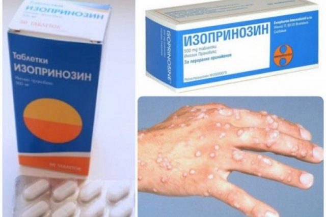 от бородавок