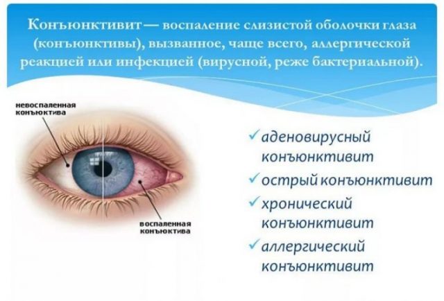 разновидности