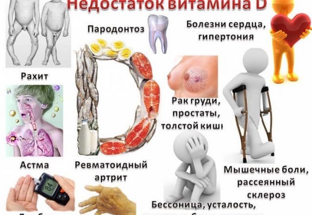 дефицит витамина Д