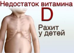рахит у детей