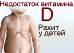 рахит у детей